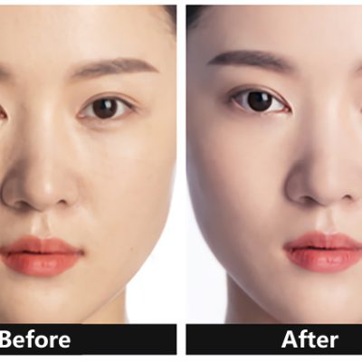 before use concealer & after use concealer